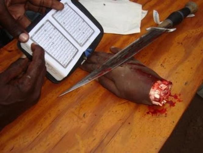 charia-amputation-e2d179a9